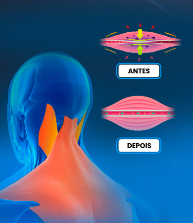 antes-e-depois-1-1.jpg