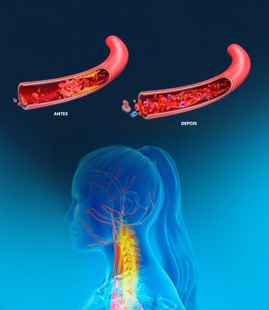 antes-e-depois-3-1.jpg